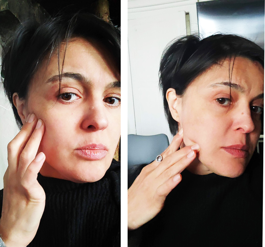 Automassage des masseteres